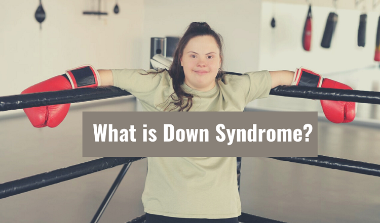 what is downsyndrome